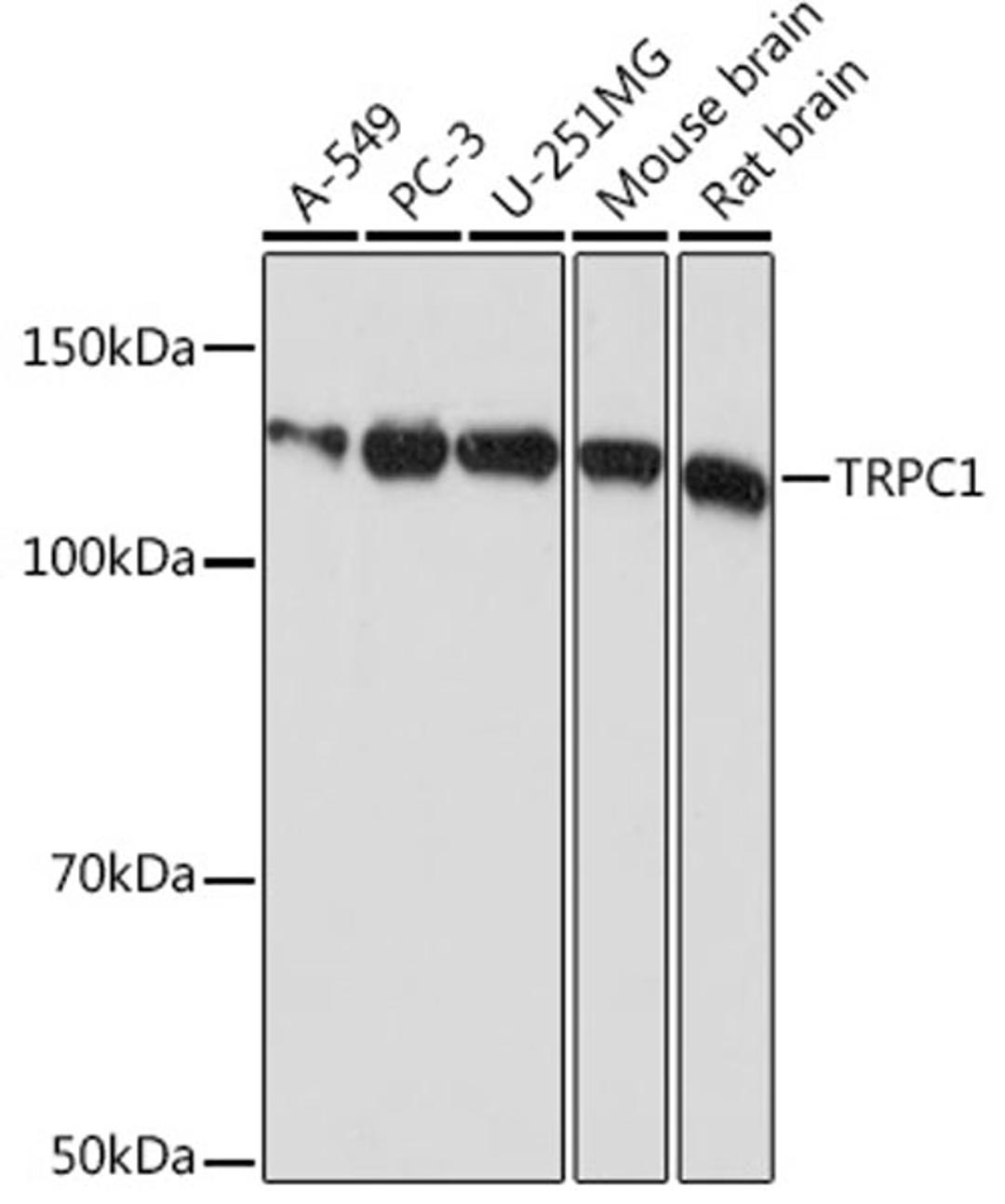 Western blot - TRPC1 Rabbit mAb (A4016)