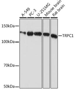 Western blot - TRPC1 Rabbit mAb (A4016)