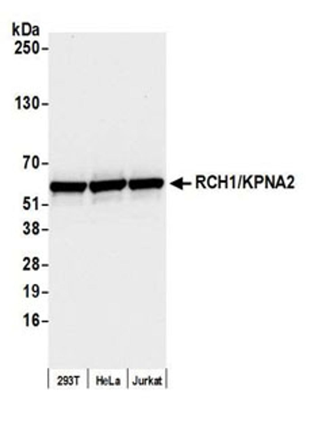 Detection of human RCH1/KPNA2 by western blot.