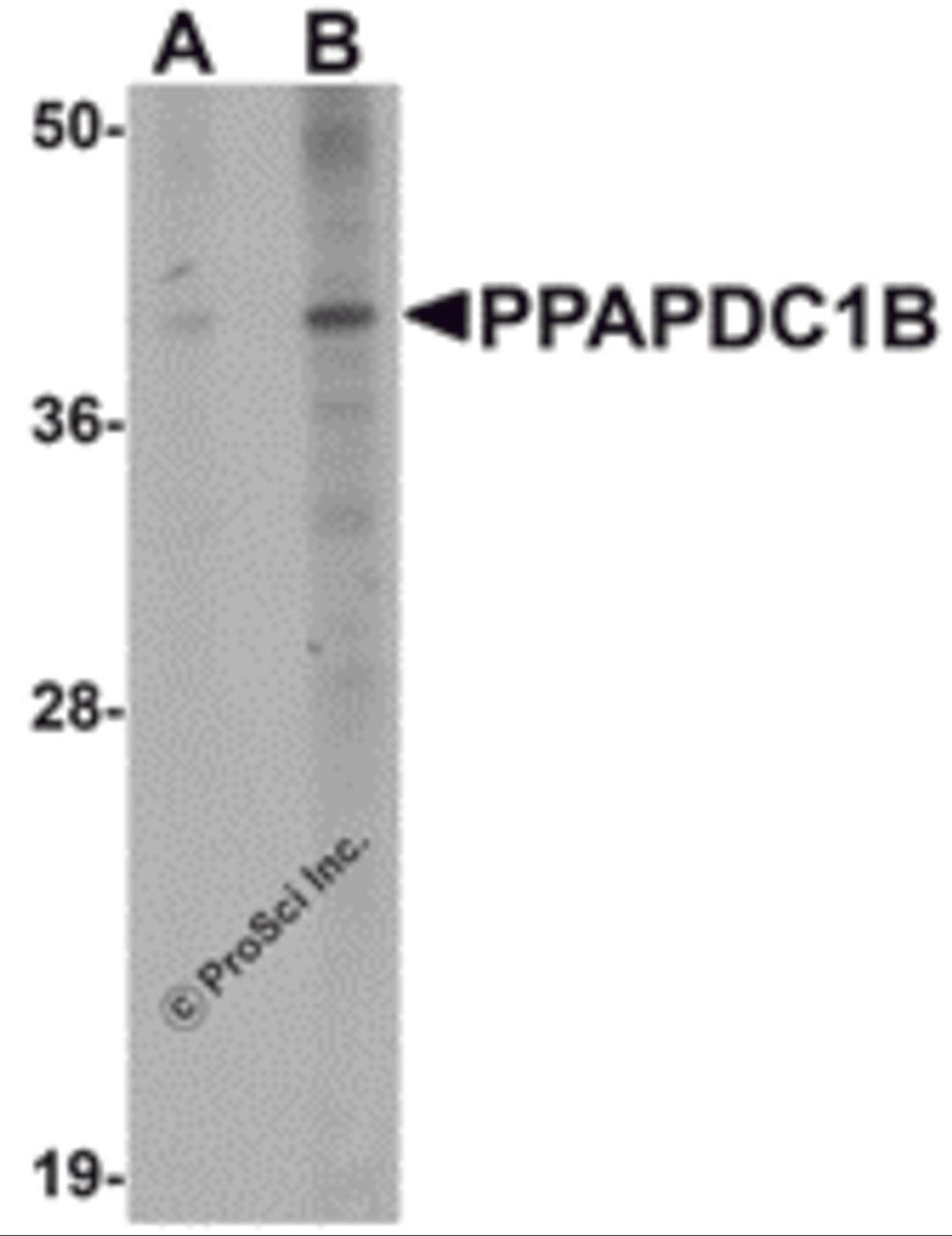 Western blot analysis of PPAPDC1B in EL4 cell lysate with PPAPDC1B antibody at (A) 1 and (B) 2 μg/mL.