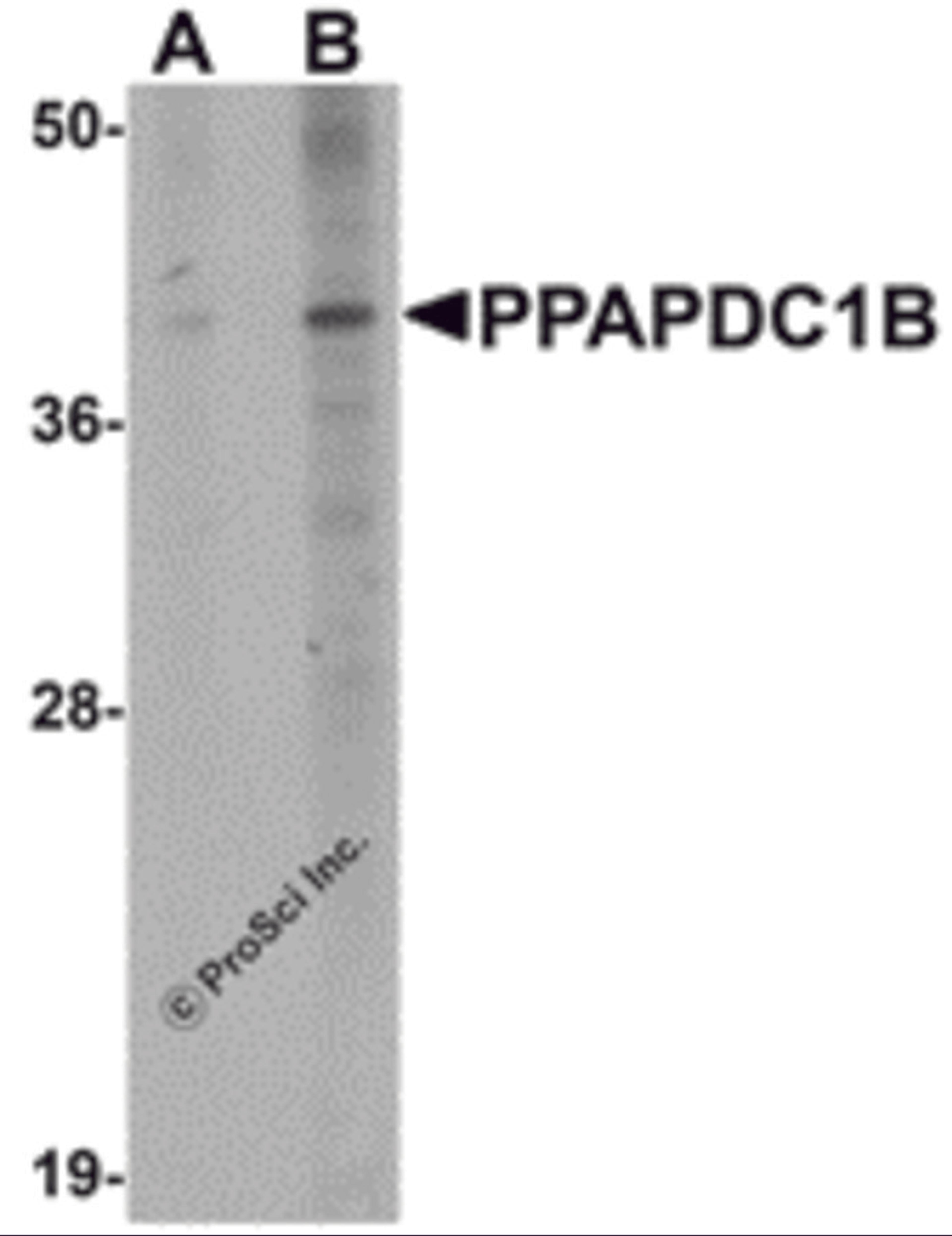 Western blot analysis of PPAPDC1B in EL4 cell lysate with PPAPDC1B antibody at (A) 1 and (B) 2 μg/mL.