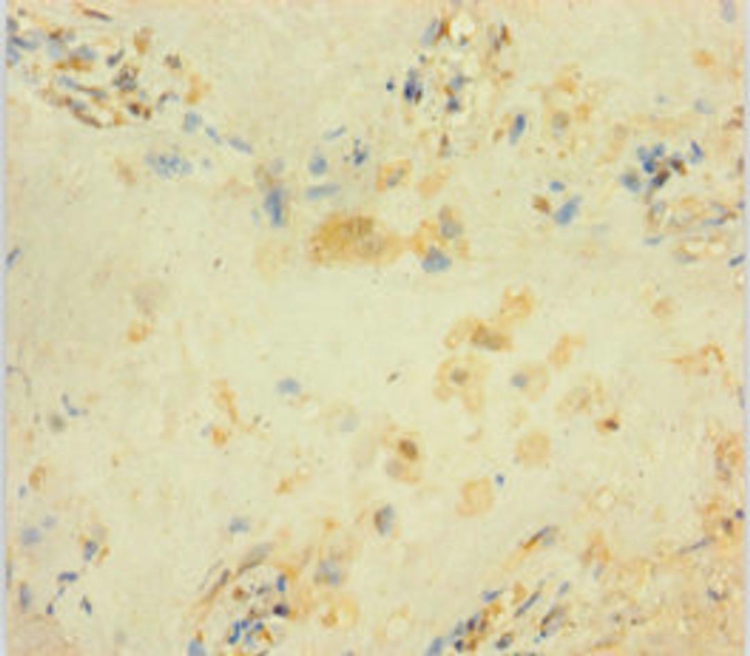 Immunohistochemistry of paraffin-embedded human placenta tissue using CSB-PA009163LA01HU at dilution of 1:100