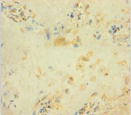 Immunohistochemistry of paraffin-embedded human placenta tissue using CSB-PA009163LA01HU at dilution of 1:100