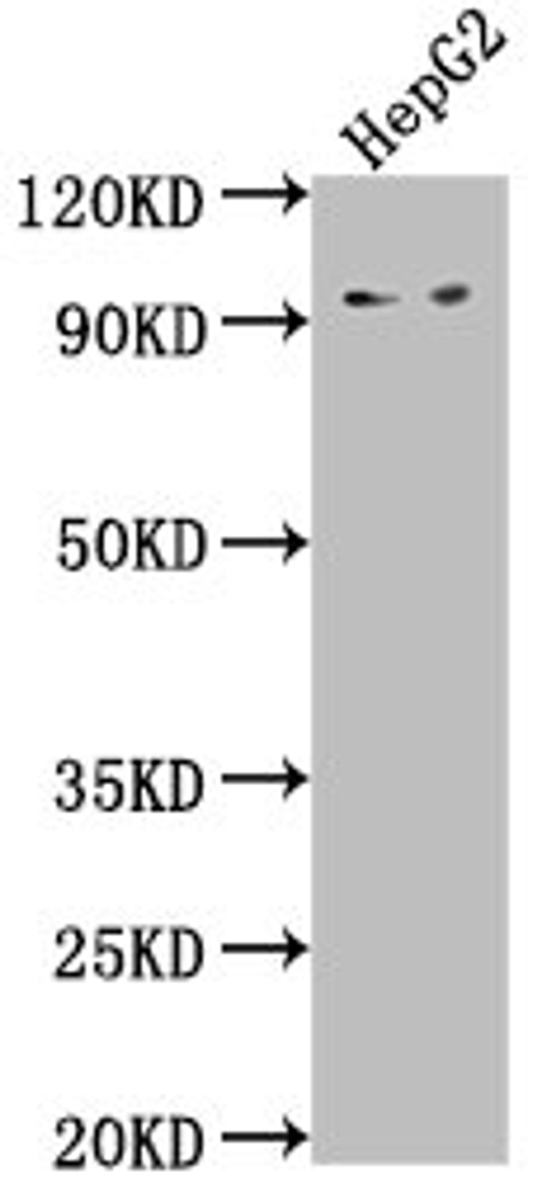 Western Blot. Positive WB detected in: HepG2 whole cell lysate. All lanes: AVIL antibody at 1:2000. Secondary. Goat polyclonal to rabbit IgG at 1/50000 dilution. Predicted band size: 93, 92 kDa. Observed band size: 93 kDa.