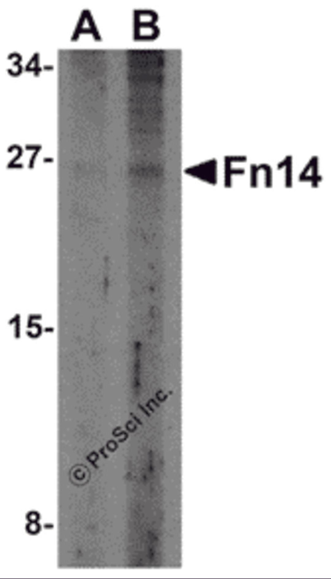 Western blot analysis of Fn14 in HepG2 cells with Fn14 antibody at (A) 2 and (B) 4 &#956;g/mL.