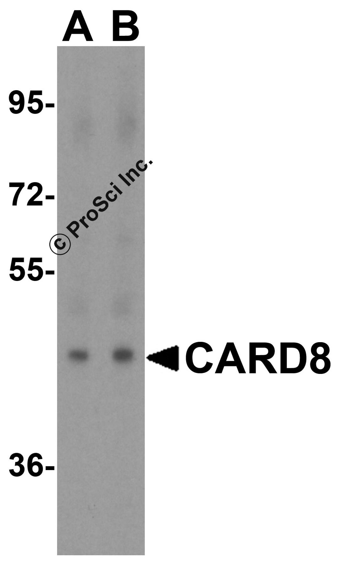 Western blot analysis of CARD8 expression in human lung tissue lysate with CARD8 antibody at (A) 1 and (B) 2 μg/ml.