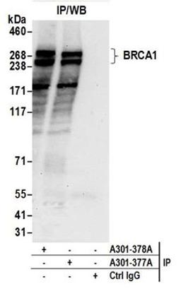 Detection of human BRCA1 by western blot of immunoprecipitates.