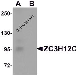 Western blot analysis of ZC3H12C in rat brain tissue lysate with ZC3H12C antibody at 1 μg/mL in (A) the absence and (B) the presence of blocking peptide.