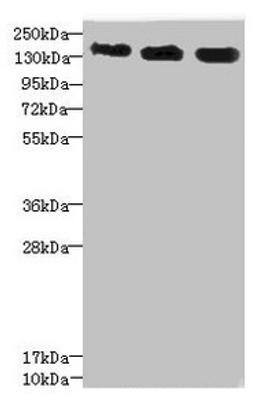 Western blot. All lanes: ANKS1B antibody at 5.28µg/ml. Lane 1: 293T whole cell lysate. Lane 2: HepG2 whole cell lysate. Lane 3: Hela whole cell lysate. Secondary. Goat polyclonal to rabbit IgG at 1/10000 dilution. Predicted band size: 139, 49, 58, 53, 52, 86, 48, 41, 29, 45 kDa. Observed band size: 139 kDa
