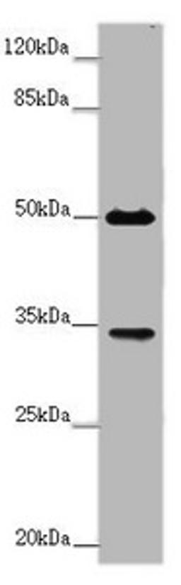 Western blot. All lanes: FCGR2B antibody at 2 ug/ml + Mouse liver tissue. Secondary. Goat polyclonal to rabbit IgG at 1/10000 dilution. Predicted band size: 35, 32, 34 kDa. Observed band size: 35, 50 kDa. 