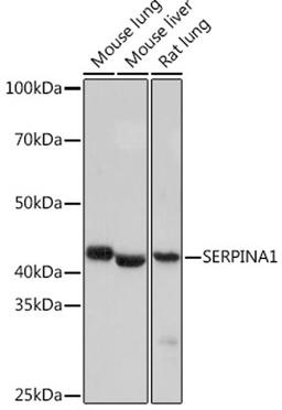 Western blot - SERPINA1 Rabbit mAb (A4966)