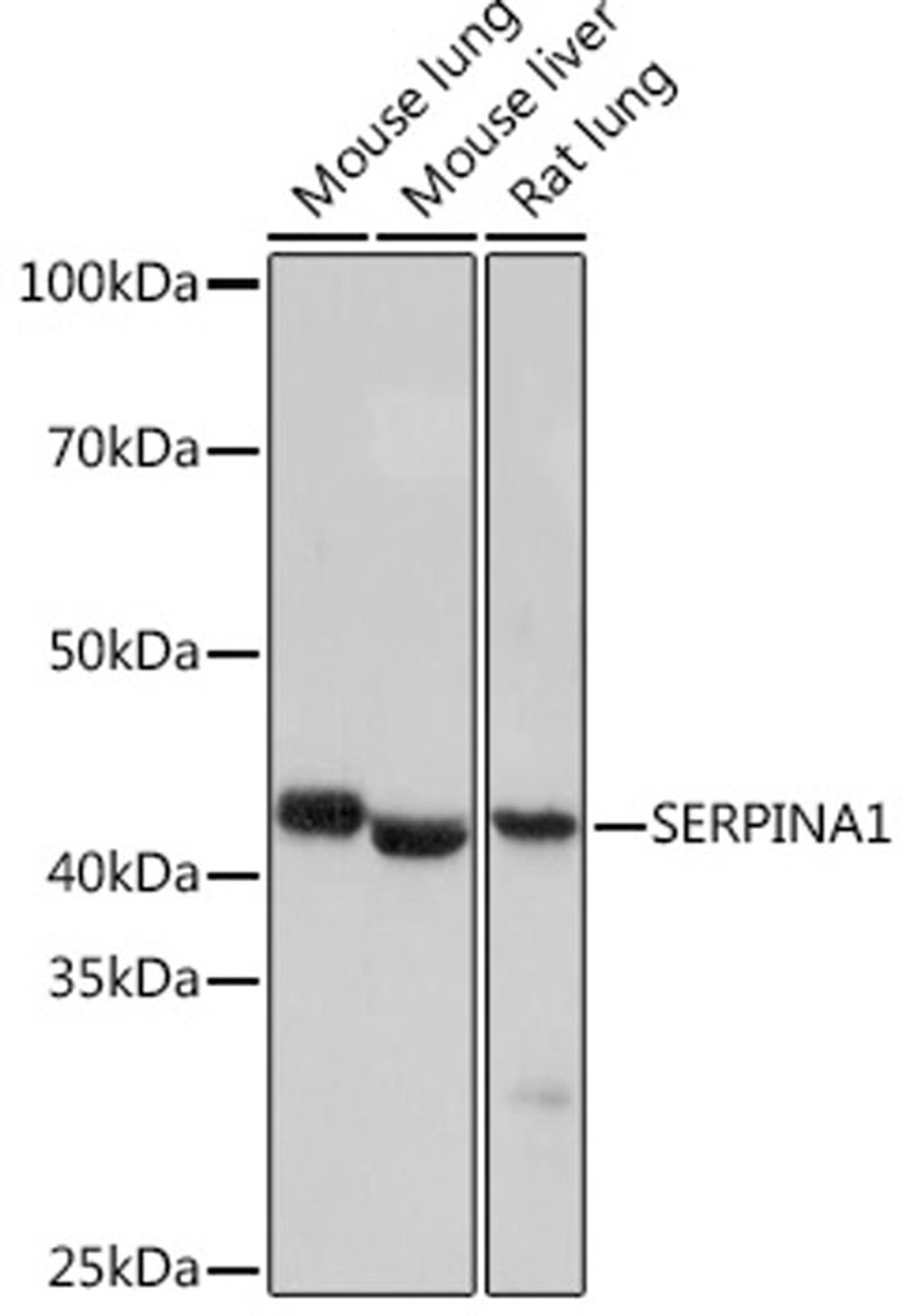 Western blot - SERPINA1 Rabbit mAb (A4966)