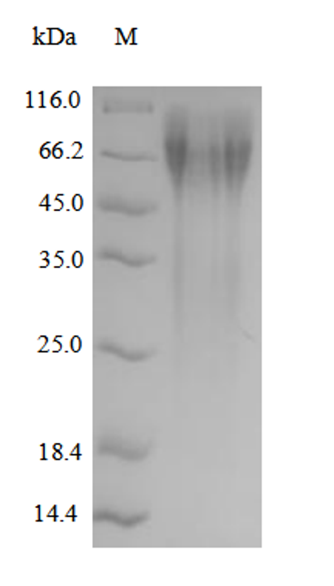 (Tris-Glycine gel) Discontinuous SDS-PAGE (reduced) with 5% enrichment gel and 15% separation gel.