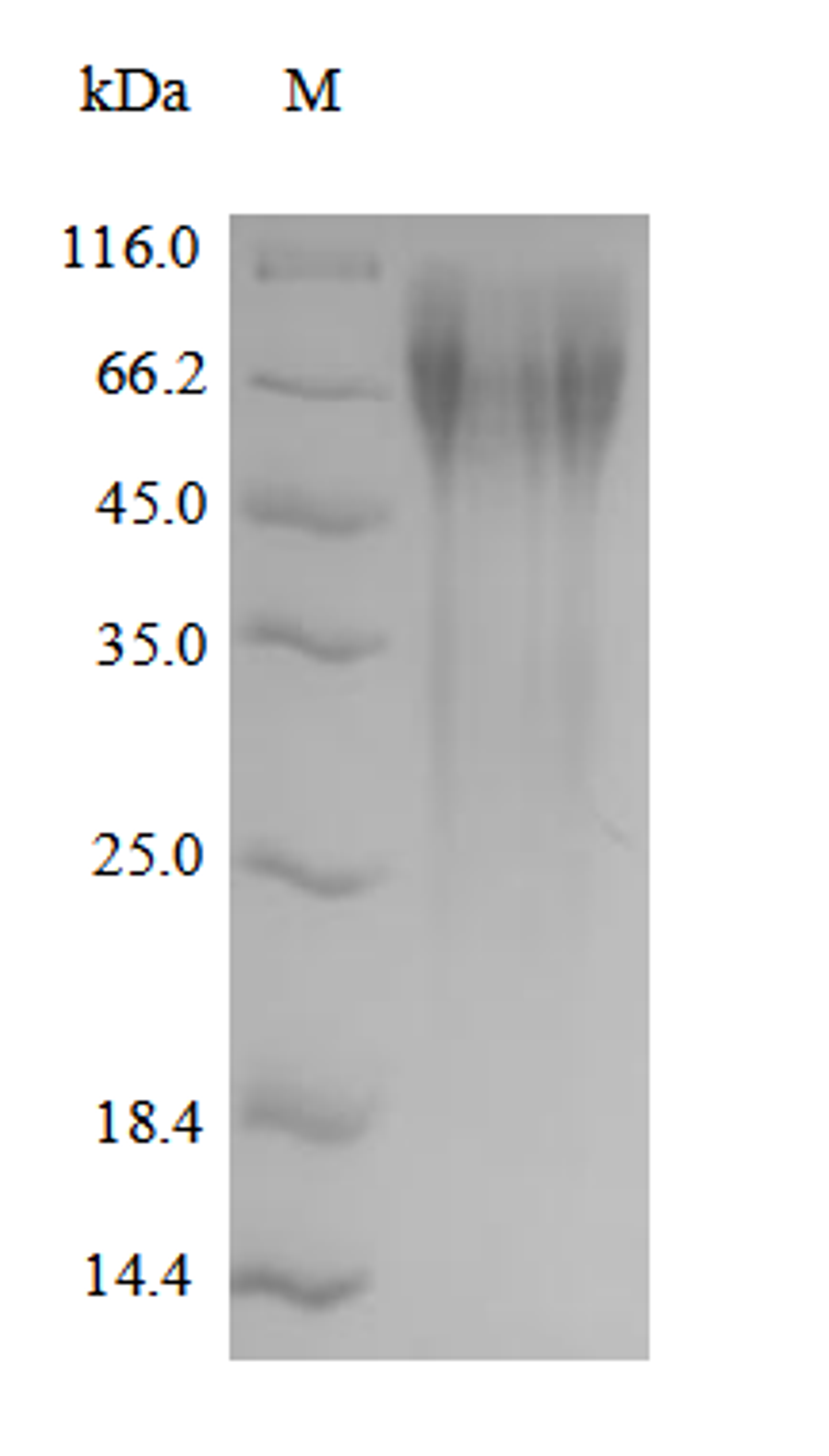 (Tris-Glycine gel) Discontinuous SDS-PAGE (reduced) with 5% enrichment gel and 15% separation gel.