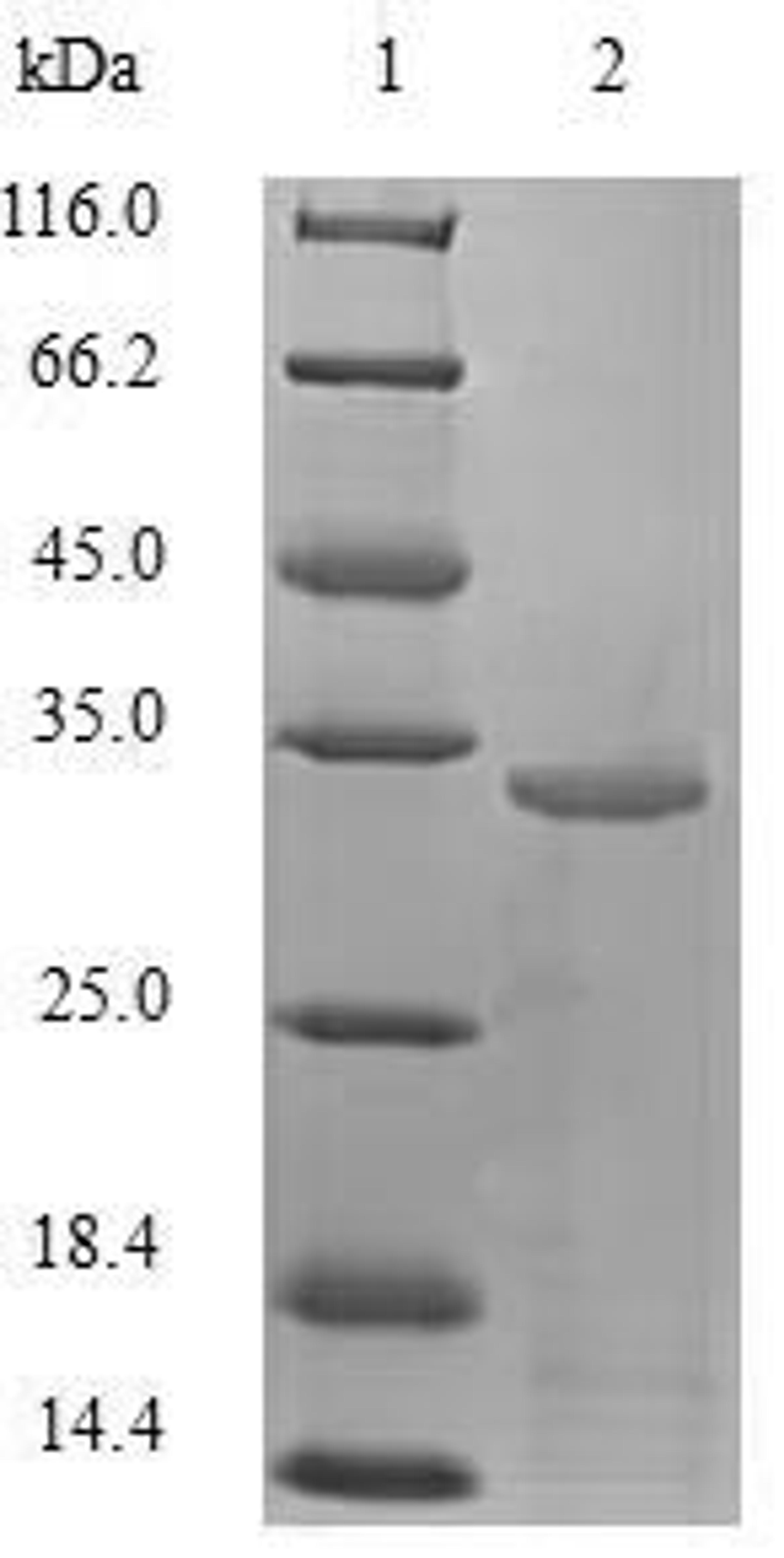 (Tris-Glycine gel) Discontinuous SDS-PAGE (reduced) with 5% enrichment gel and 15% separation gel.