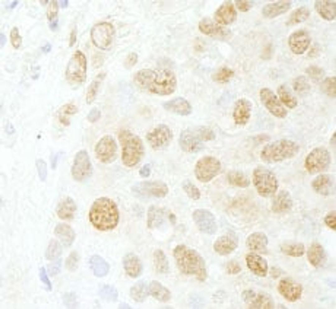 Detection of human CDC5L by immunohistochemistry.