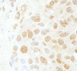 Detection of human CDC5L by immunohistochemistry.