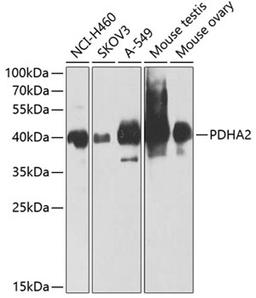 Western blot - PDHA2 antibody (A9943)