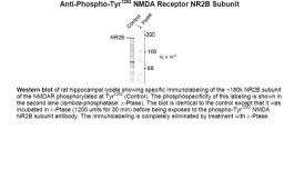 Western blot of rat hippocampal lysate showing specific immunolabeling of the ~180k NR2B subunit of the NMDAR phosphorylated at Tyr1252 (Control). The phosphospecificity of this labeling is shown in the second lane (lambda-phosphatase: lamda-Ptase). The b