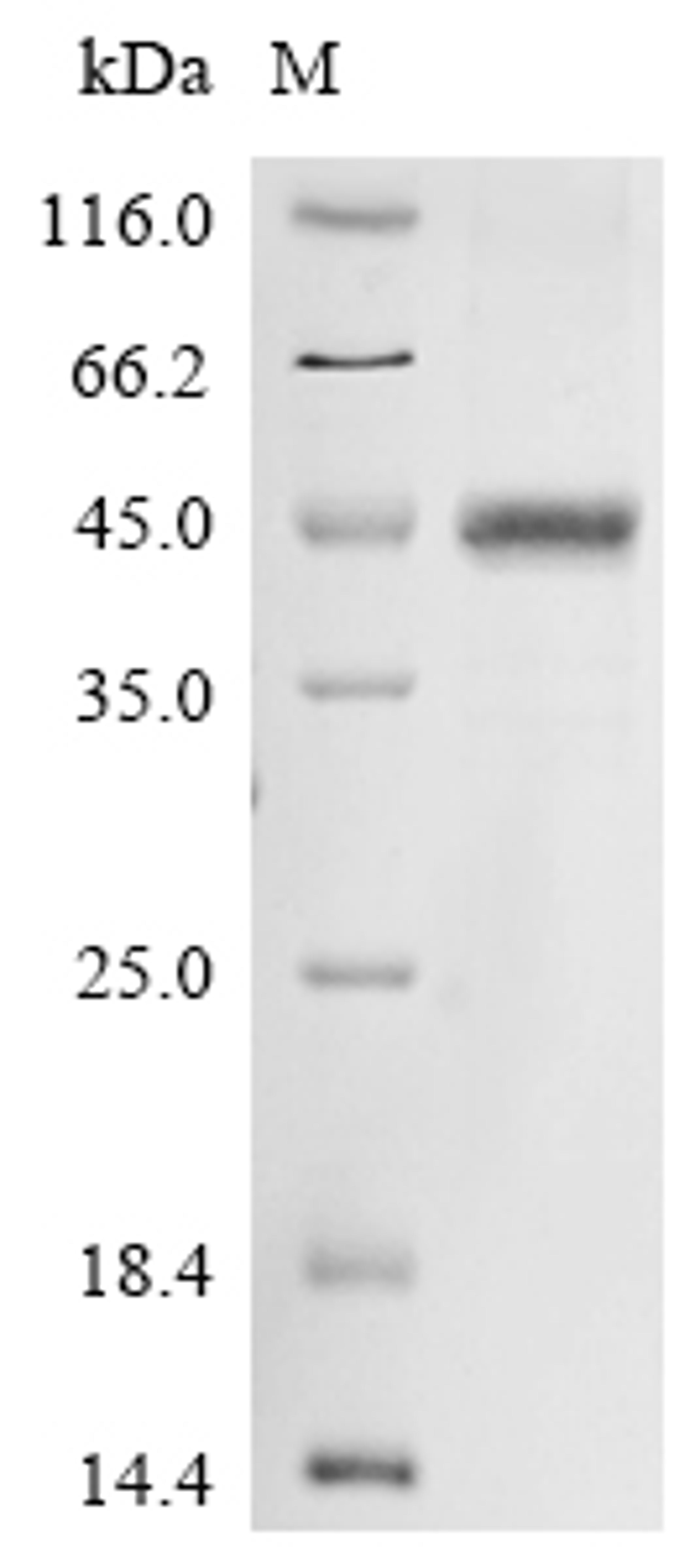 (Tris-Glycine gel) Discontinuous SDS-PAGE (reduced) with 5% enrichment gel and 15% separation gel.