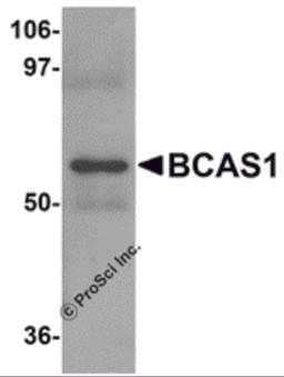 Western blot analysis of BCAS1 in human lung tissue lysate with BCAS1 antibody at 1 μg/mL.