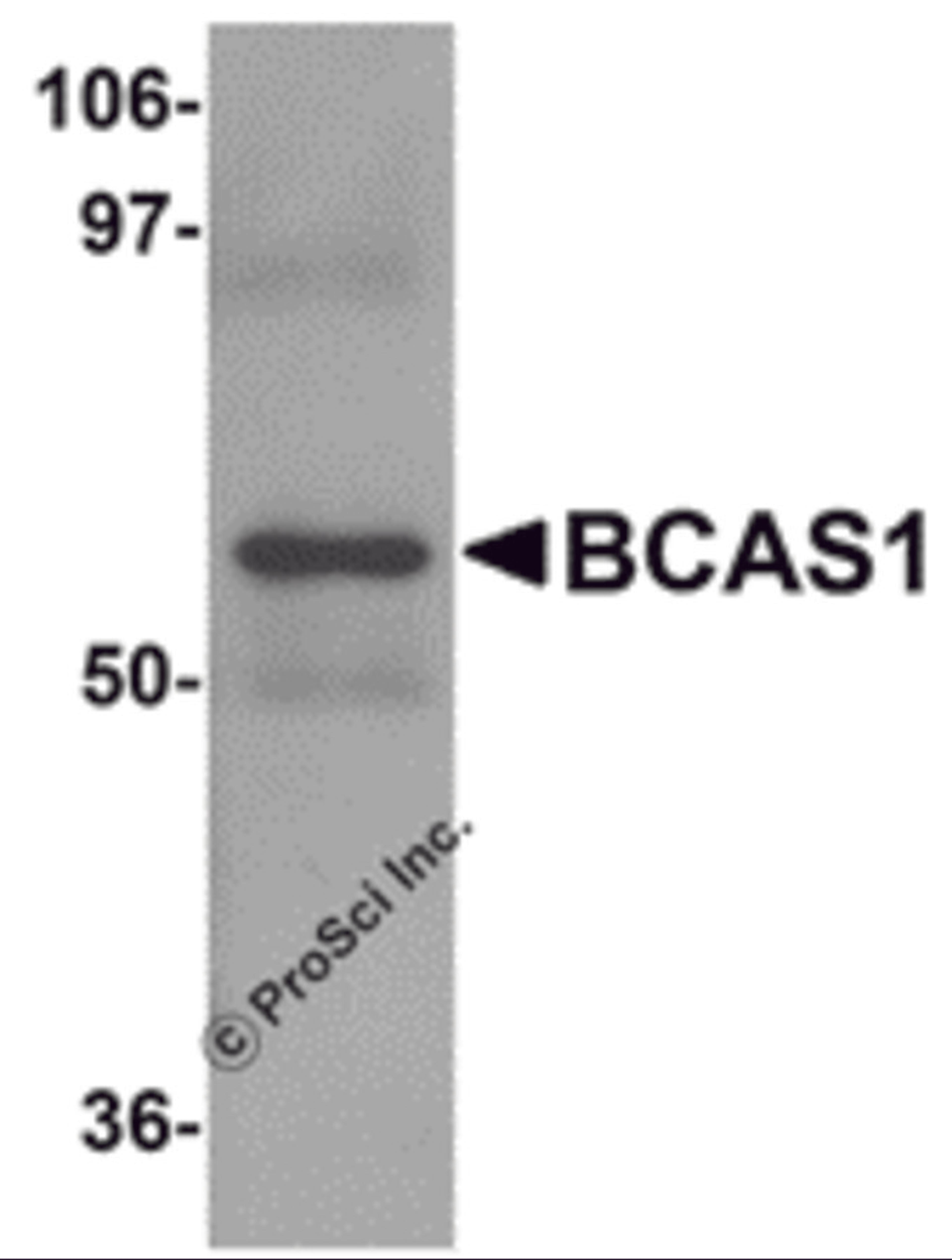 Western blot analysis of BCAS1 in human lung tissue lysate with BCAS1 antibody at 1 μg/mL.