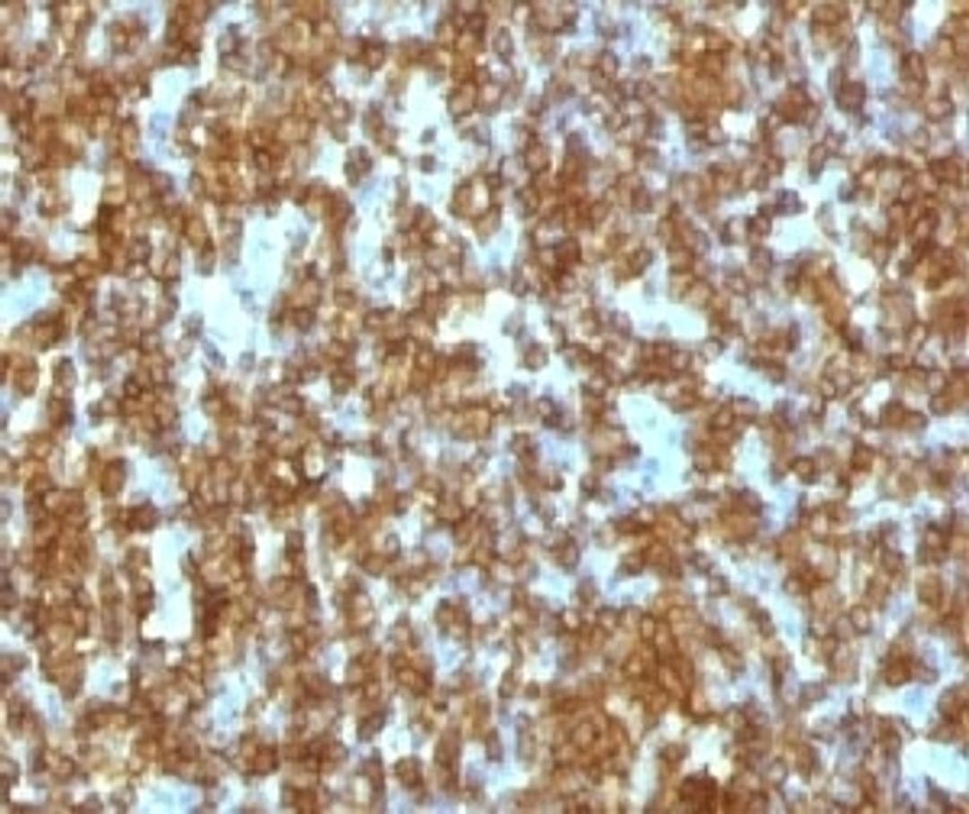 IHC testing of FFPE human tonsil and anti-CD45RA antibody (CDLA45RA-1)