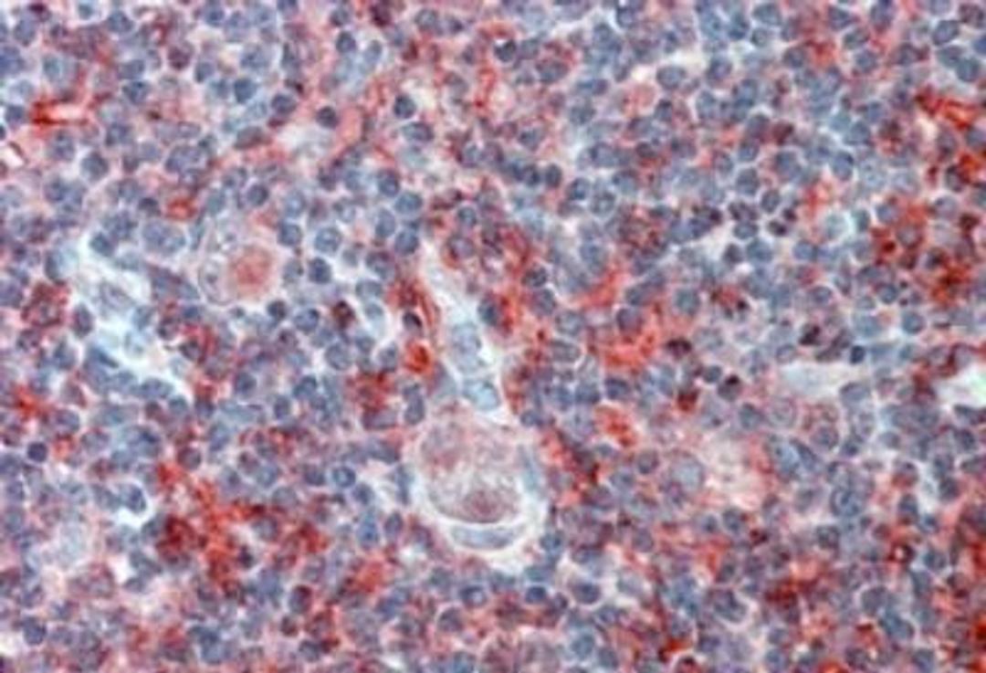 Immunohistochemistry-Paraffin: IGSF4C/SynCAM4 Antibody [NBP1-00164] - (2.5ug/ml) staining of paraffin embedded Human Thymus. Steamed antigen retrieval with citrate buffer pH 6, AP-staining.