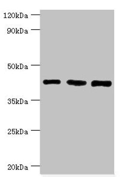 Western blot. All lanes: SWI/SNF-related matrix-associated actin-dependent regulator of chromatin subfamily B member 1 antibody at 8ug/ml. Lane 1: Hela whole cell lysate. Lane 2: 293T whole cell lysate. Lane 3: Mouse stomach tissue. Secondary. Goat polyclonal to rabbit IgG at 1/10000 dilution. Predicted band size: 45, 44 kDa. Observed band size: 45 kDa.