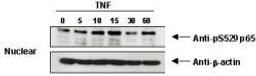 Western blot analysis of KBM-5 cells. using NFkB p65 (phospho-S529) antibody