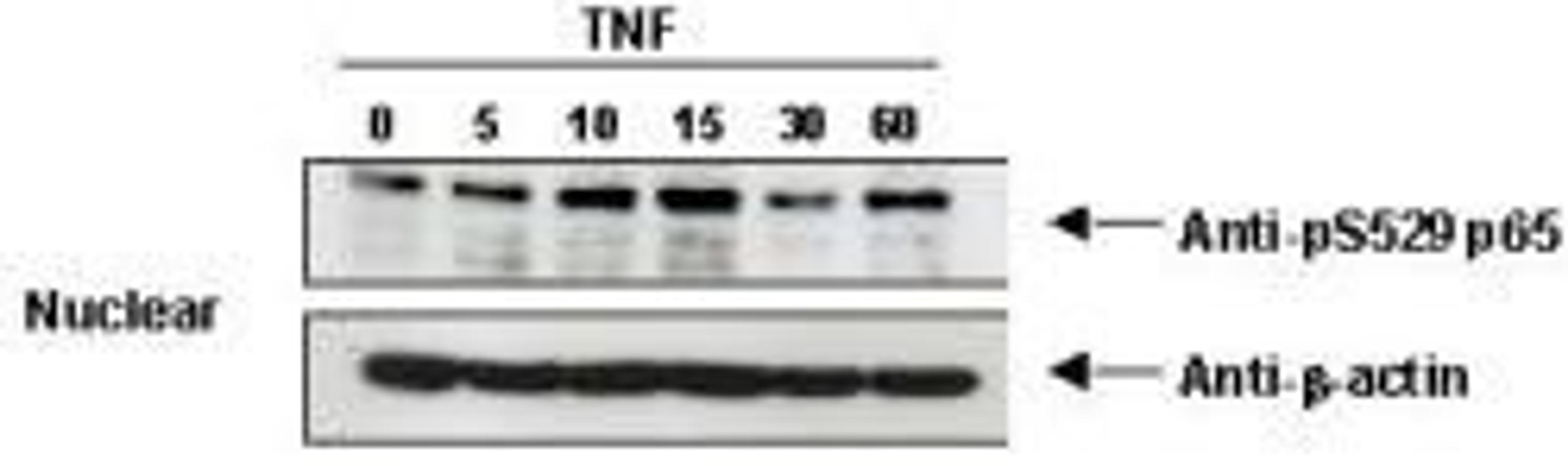 Western blot analysis of KBM-5 cells. using NFkB p65 (phospho-S529) antibody