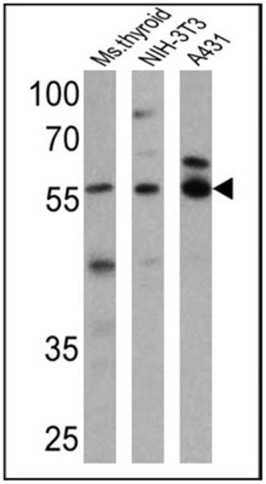 Western Blot: TR alpha/NR1A1/Thyroid Hormone Receptor alpha Antibody [NBP2-22523] - Analysis of 25 ug of mouse thyroid (lane 1), NIH-3T3 (lane 2) and A431 (lane 3) cell lysates onto an SDS polyacrylamide gel.