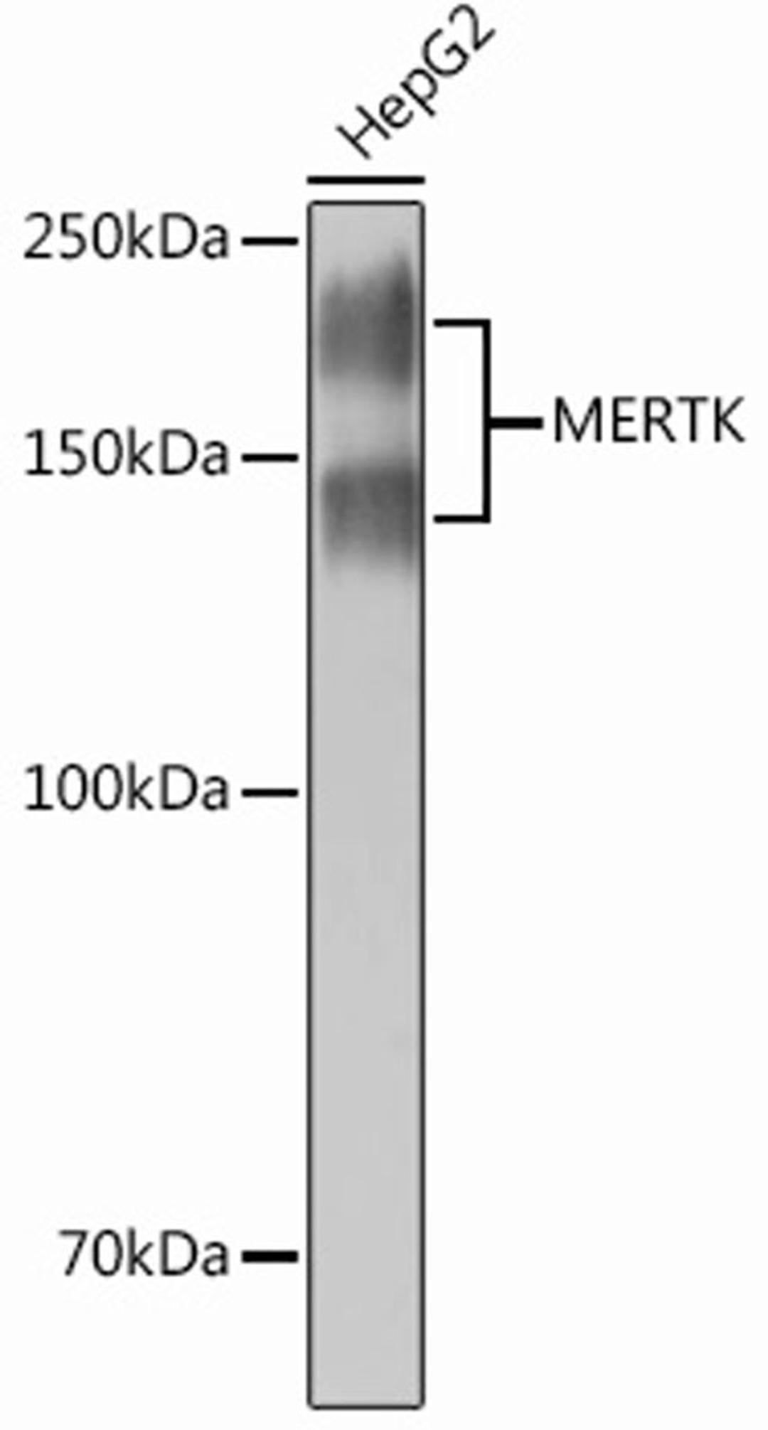 Western blot - MERTK Rabbit mAb (A12294)