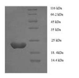 (Tris-Glycine gel) Discontinuous SDS-PAGE (reduced) with 5% enrichment gel and 15% separation gel.