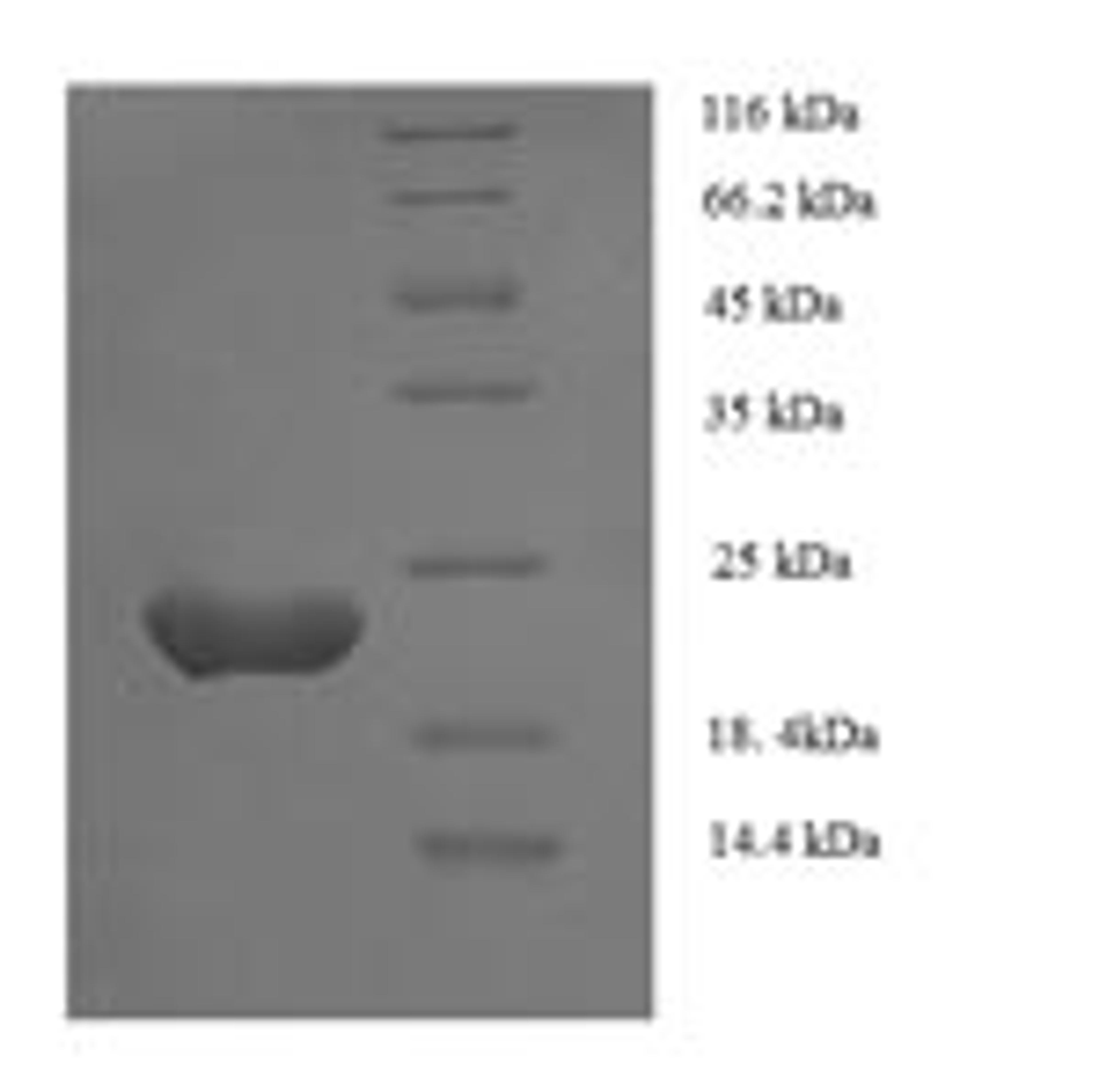 (Tris-Glycine gel) Discontinuous SDS-PAGE (reduced) with 5% enrichment gel and 15% separation gel.