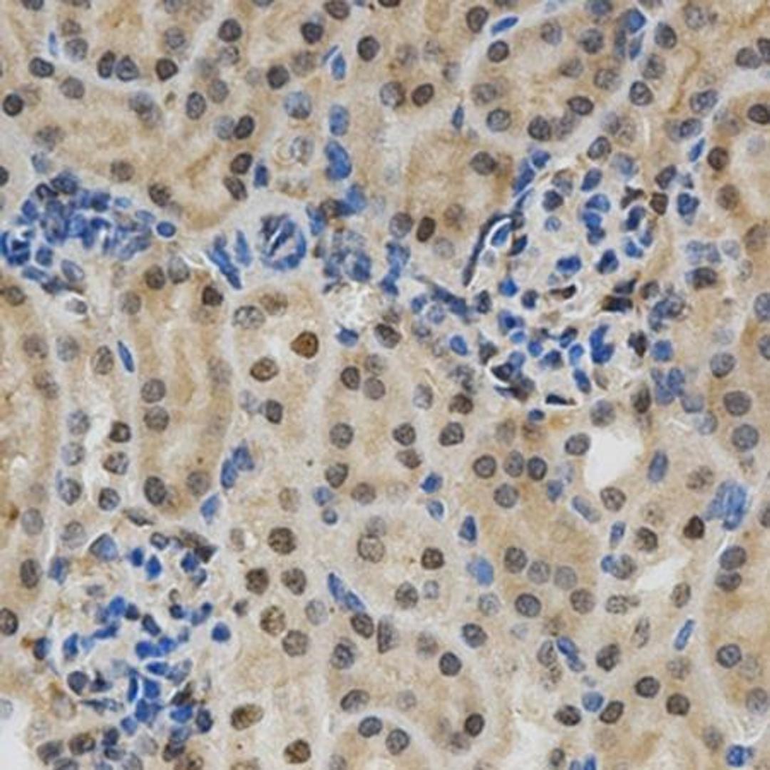 IHC-P staining of mouse kidney tissue using Galectin 3 antibody (primary antibody dilution at 1:200)