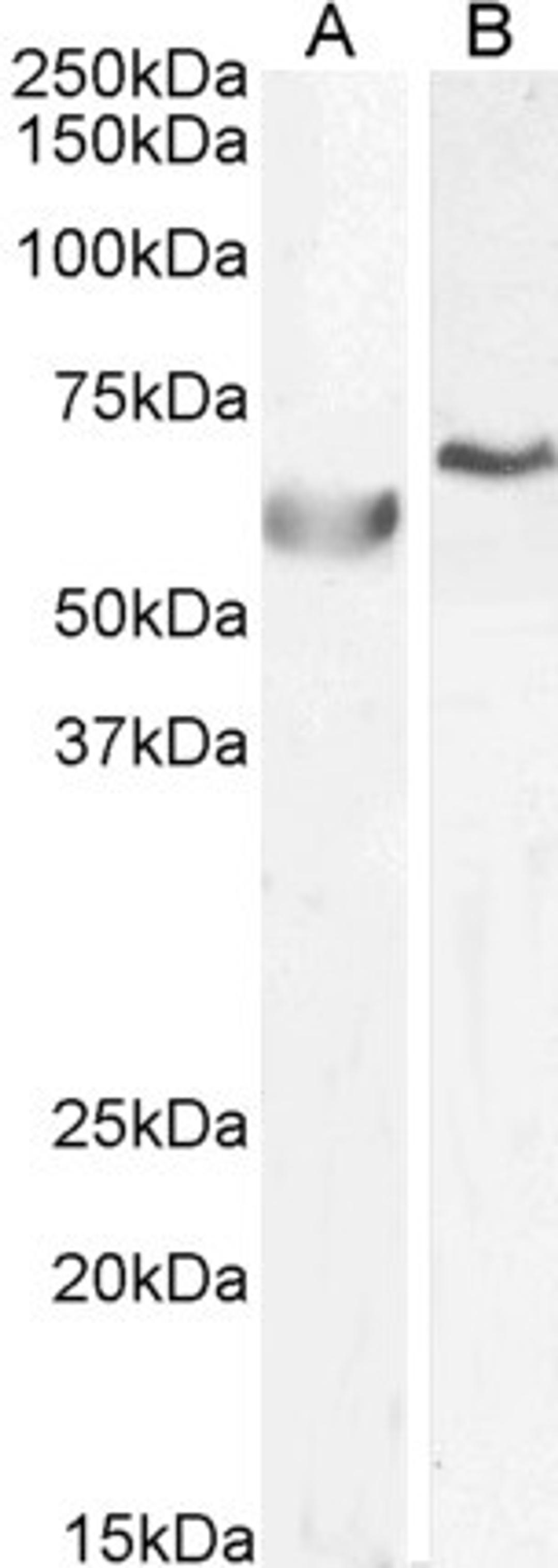 46-207 (0.5ug/ml) staining of A549 (A) and (1ug/ul) HepG2 (B) cell lysate (35ug protein in RIPA buffer). Primary incubation was 1 hour. Detected by chemiluminescence.