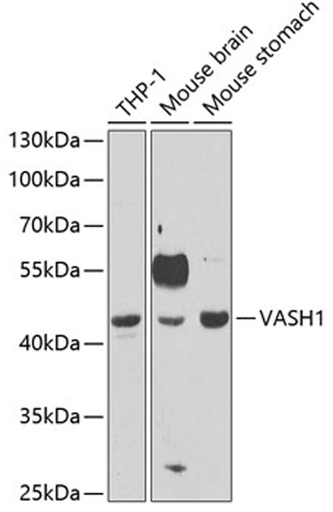 Western blot - VASH1 antibody (A6148)