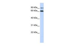 Antibody used in WB on Human HepG2 at 0.2-1 ug/ml.