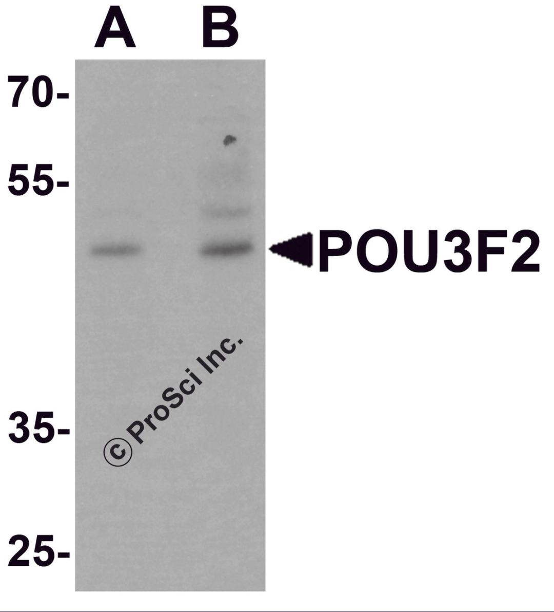 Western blot analysis of POU3F2 in 3T3 cell lysate with POU3F2 antibody at (A) 1 and (B) 2 μg/mL.