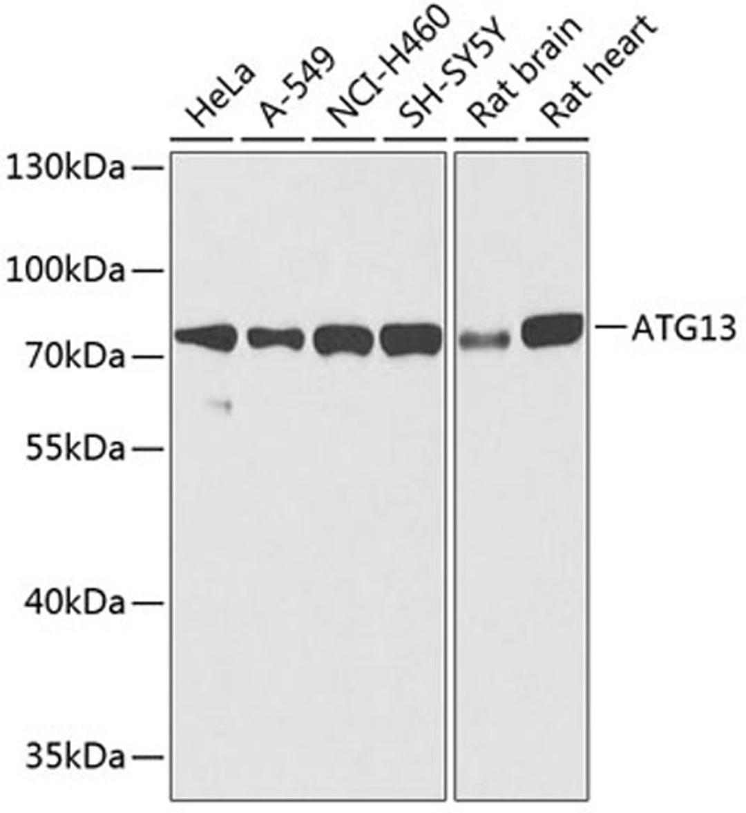 Western blot - ATG13 antibody (A0690)