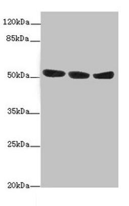 Western blot. All lanes: KYNU antibody at 1.44ug/ml. Lane 1: A549 whole cell lysate. Lane 2: HepG2 whole cell lysate. Lane 3: Hela whole cell lysate. Secondary. Goat polyclonal to rabbit IgG at 1/10000 dilution. Predicted band size: 53, 35 kDa. Observed band size: 53 kDa. 