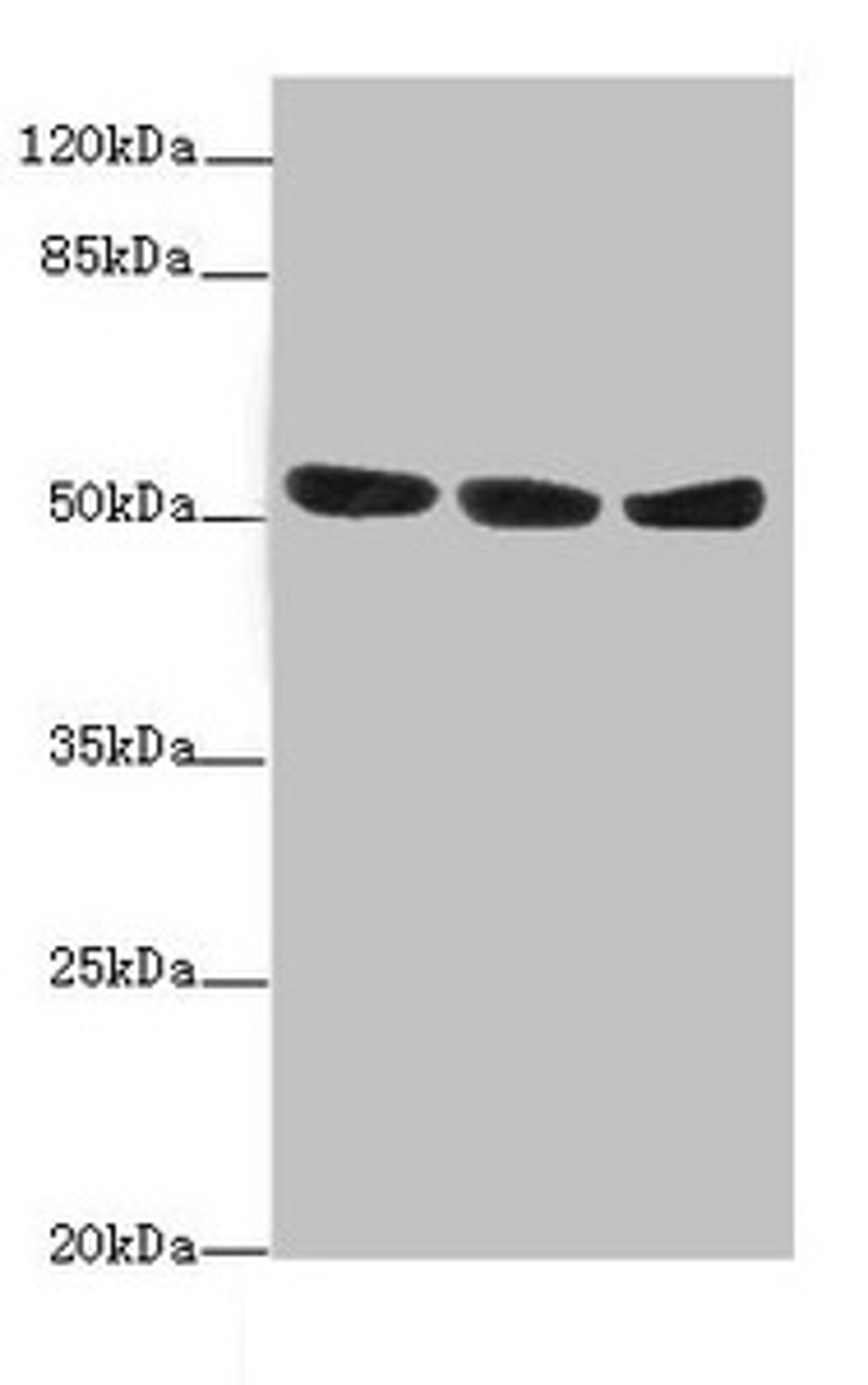 Western blot. All lanes: KYNU antibody at 1.44ug/ml. Lane 1: A549 whole cell lysate. Lane 2: HepG2 whole cell lysate. Lane 3: Hela whole cell lysate. Secondary. Goat polyclonal to rabbit IgG at 1/10000 dilution. Predicted band size: 53, 35 kDa. Observed band size: 53 kDa. 