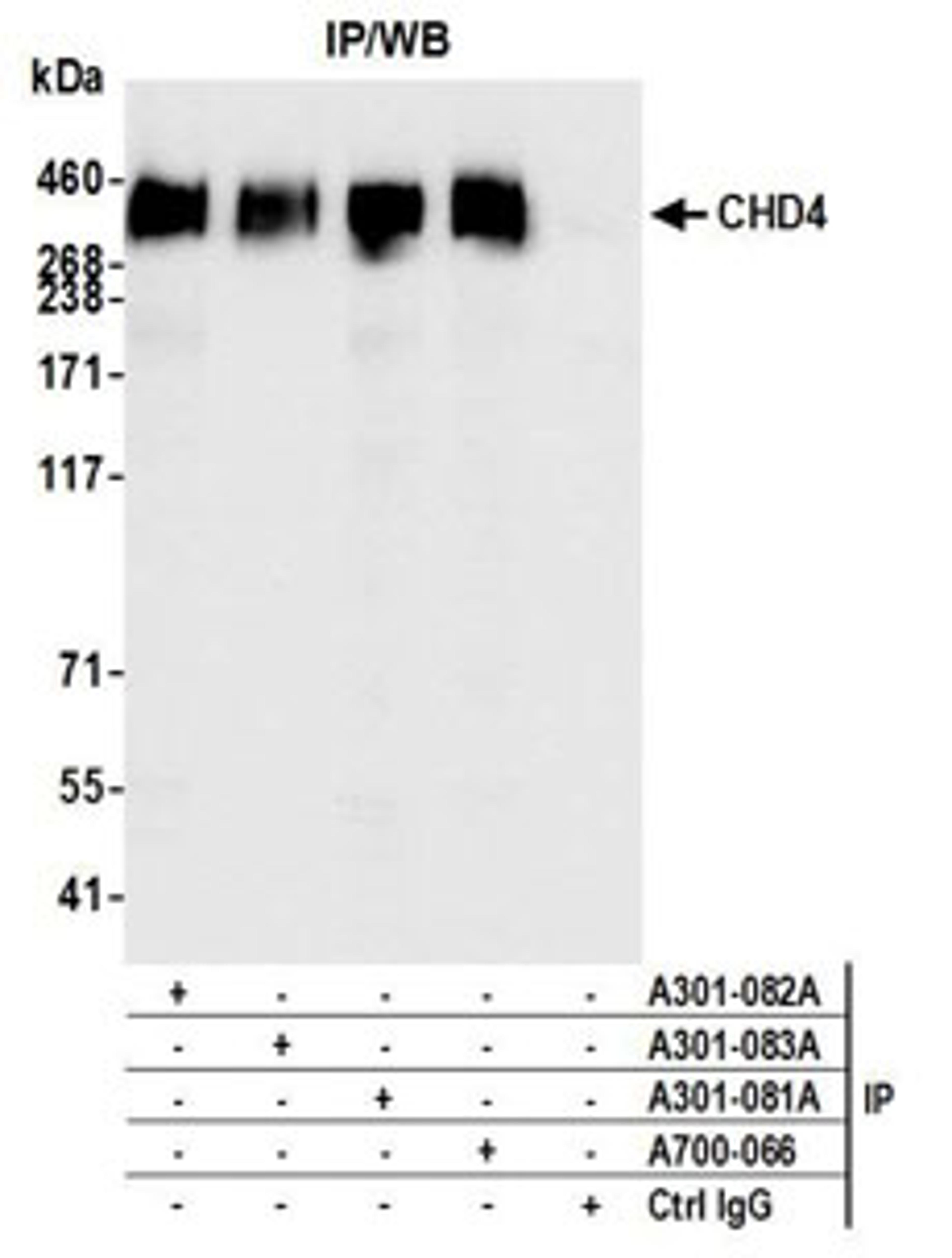 Detection of human CHD4 by western blot of immunoprecipitates.