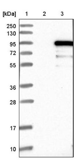 Western Blot: ZNF96 Antibody [NBP1-88018] - Lane 1: Marker [kDa] 250, 130, 95, 72, 55, 36, 28, 17, 10<br/>Lane 2: Negative control (vector only transfected HEK293T lysate)<br/>Lane 3: Over-expression lysate (Co-expressed with a C-terminal myc-DDK tag (~3.1 kDa) in mammalian HEK293T cells, LY422096)