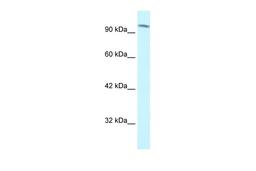 Antibody used in WB on Human Jurkat cells at 1.25 ug/ml.