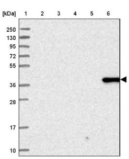 Immunohistochemistry: ANKRD2 Antibody [NBP1-91669] - Lane 1: Marker [kDa] 250, 130, 95, 72, 55, 36, 28, 17, 10<br/>Lane 2: Human cell line RT-4<br/>Lane 3: Human cell line U-251MG sp<br/>Lane 4: Human plasma (IgG/HSA depleted)<br/>Lane 5: Human liver tissue<br/>Lane 6: Human tonsil tissue