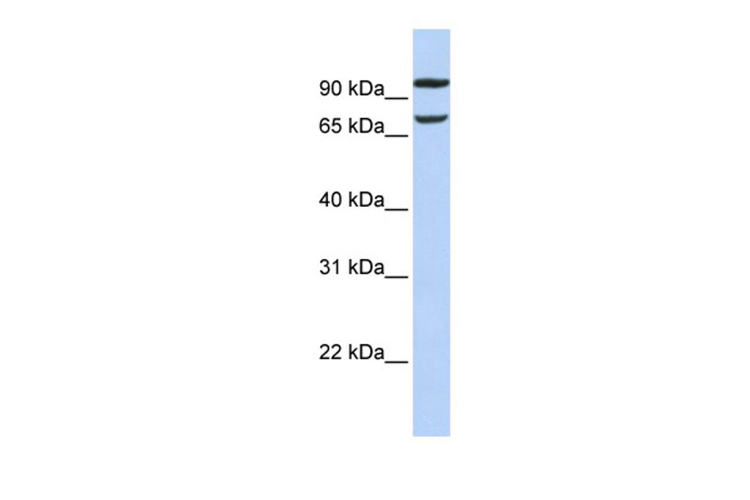 Antibody used in WB on Human 721_B at 0.2-1 ug/ml.