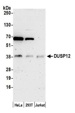 Detection of human DUSP12 by WB.