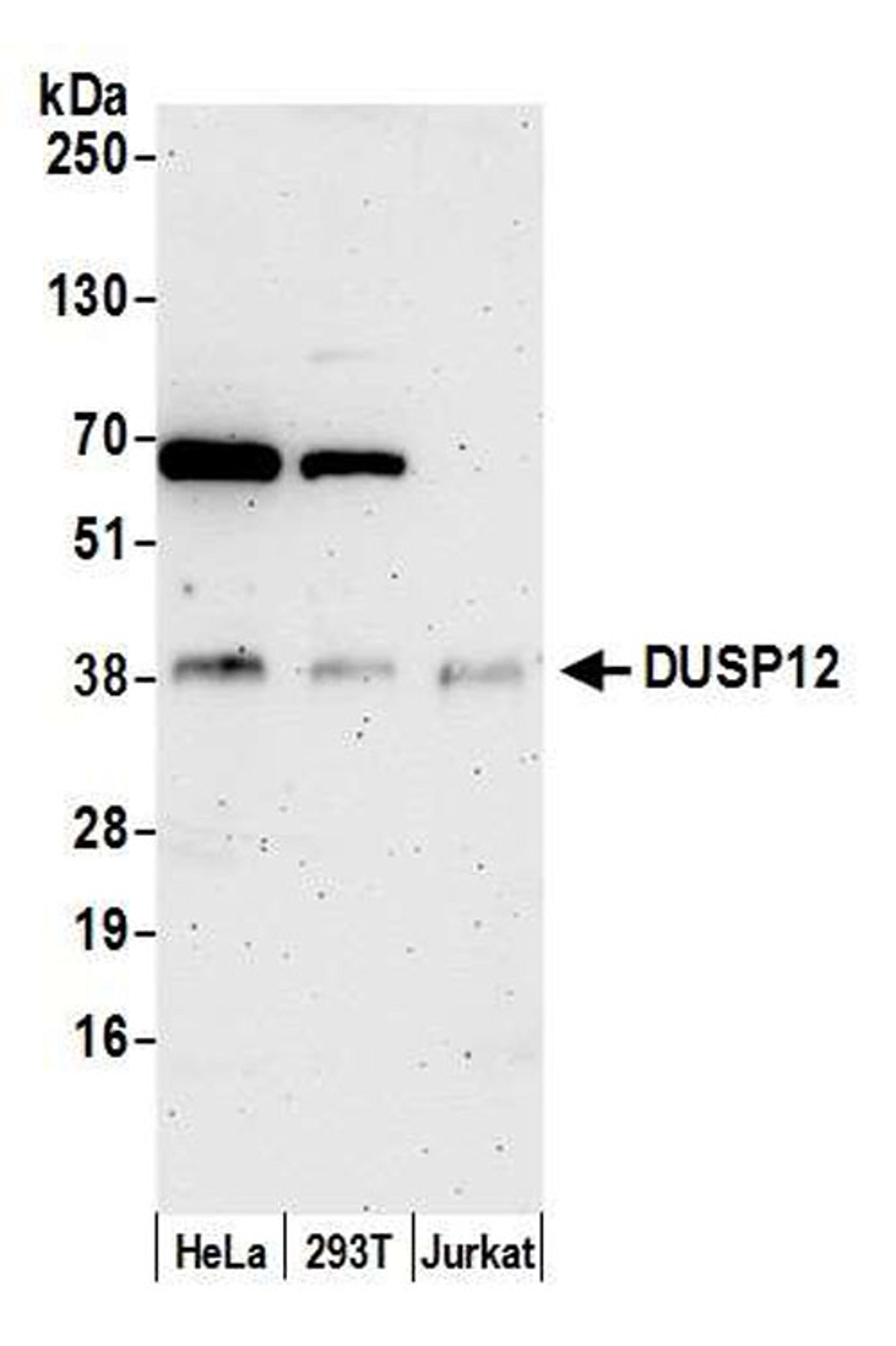 Detection of human DUSP12 by WB.